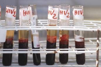 Aids, l'accusa di Bassetti: &quot;Torna a far paura per colpa di Trump&quot;
