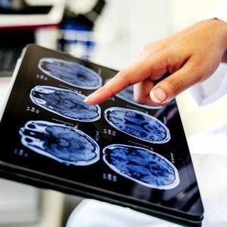 ATS Liguria lancia il progetto PREVE.D.I. per la diagnosi precoce di ictus e demenze ATS Liguria lancia il progetto PREVE.D.I. per la diagnosi precoce di ictus e demenze