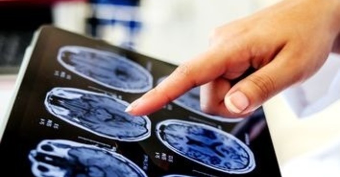 ATS Liguria lancia il progetto PREVE.D.I. per la diagnosi precoce di ictus e demenze