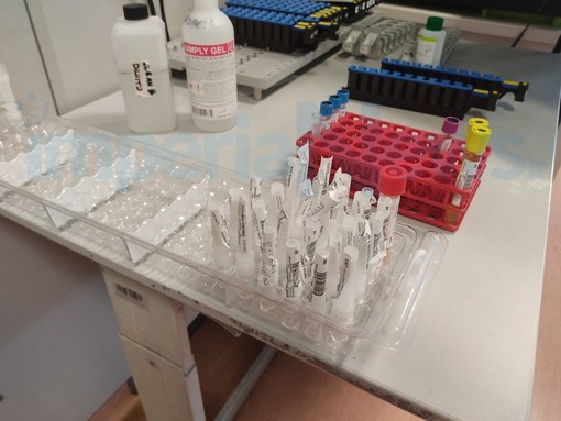 Coronavirus: stazionario il tasso di positività (14,02%), nella nostra provincia oggi 30 nuovi casi Coronavirus: stazionario il tasso di positività (14,02%), nella nostra provincia oggi 30 nuovi casi