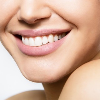 White Identity: a Natale regala la prevenzione e  un sorriso perfetto e in salute