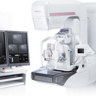 L'Asl 1 si aggiudica un mammografo di ultima generazione: donato grazie alla partnership tra Roche e Fujifilm Italia