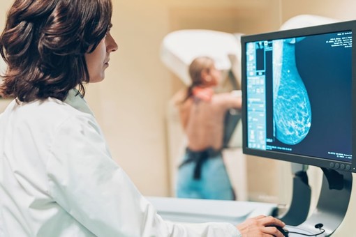 Prevenzione del tumore al seno: screening al livello del pre covid, obiettivo 8 mila mammografie all’anno (intervista)