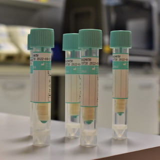 Coronavirus: arrivati in Liguria i test salivari per avvio monitoraggio del covid-19 nelle scuole, consegnati altri 600 per Asl1, Asl2 e Asl5