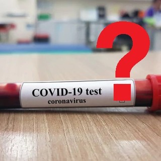 Coronavirus e test sierologici Covid-19: da Avis le informazioni per i donatori di sangue Coronavirus e test sierologici Covid-19: da Avis le informazioni per i donatori di sangue