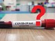 Coronavirus e test sierologici Covid-19: da Avis le informazioni per i donatori di sangue Coronavirus e test sierologici Covid-19: da Avis le informazioni per i donatori di sangue