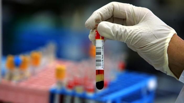 Imperia, il centro prelievi "trasloca" al palazzetto dello sport sino a 31 luglio: l'Asl 1 procede spedita per la vaccinazione anti-covid