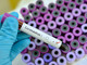 Coronavirus, nove nuovi casi nel Principato di Monaco. Oggi si registrano anche sette guarigioni