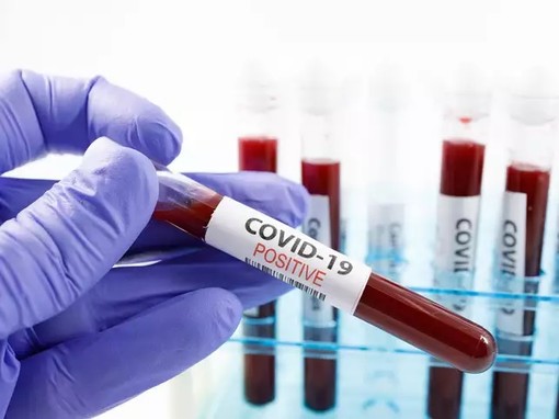 Coronavirus: calano lievemente i numeri, 107 positivi nella nostra provincia e 999 in Regione (uno ogni 6,2 tamponi)