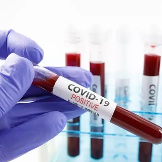 Coronavirus: aumenta il tasso di positività (8,42%) e il numero dei contagi in provincia ma calano quelli in ospedale