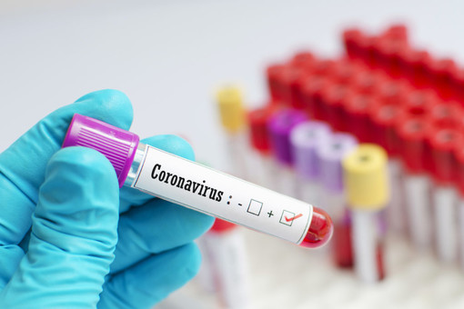 Coronavirus, migliora il quadro nella nostra provincia: Imperia registra un netto calo, Taggia invece è il comune con il maggior numero di contagiati