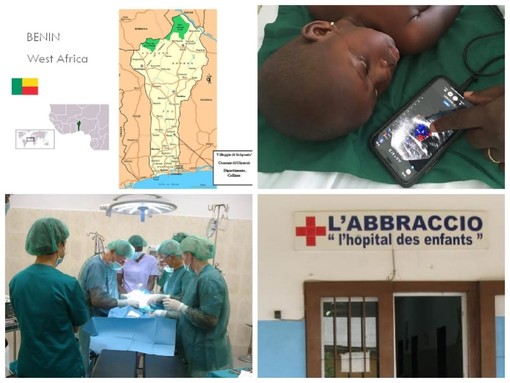 Un 'Abbraccio' grande che parte da Imperia e arriva in Africa: donato un ecografo portatile all'ospedale pediatrico nel Benin