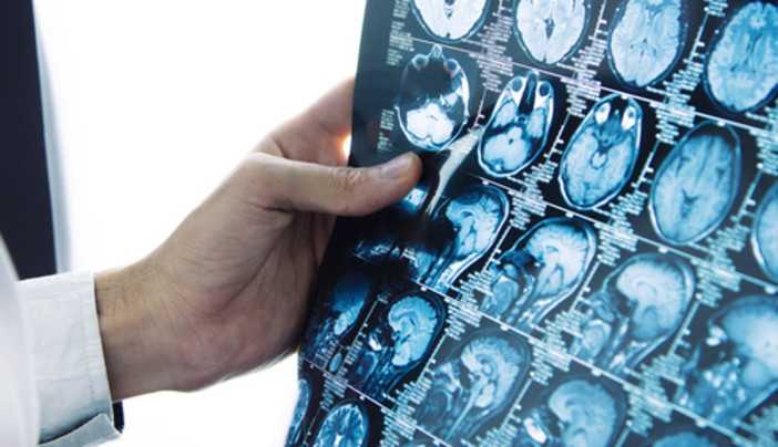 La Liguria acquista oltre 130.000 prestazioni di diagnostica per immagini, Toti: "Con delibera di Alisa, arriva contributo decisivo per lotta alle liste d’attesa"