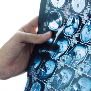 La Liguria acquista oltre 130.000 prestazioni di diagnostica per immagini, Toti: "Con delibera di Alisa, arriva contributo decisivo per lotta alle liste d’attesa"