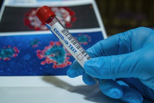 Coronavirus: in provincia di Imperia 27 nuovi casi e un totale di 477 positivi. I ricoverati sono 22, due in terapia intensiva