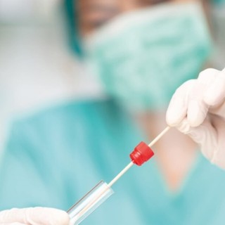 Somministrazione dei tamponi antigenici rapidi, il programma da lunedì a venerdì in Asl1 Imperiese