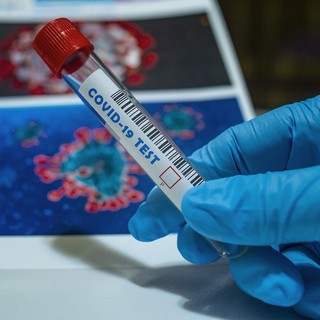 Coronavirus: 38 nuovi casi in regione, dati stabili in provincia di Imperia. Tasso di positività al 2,32%