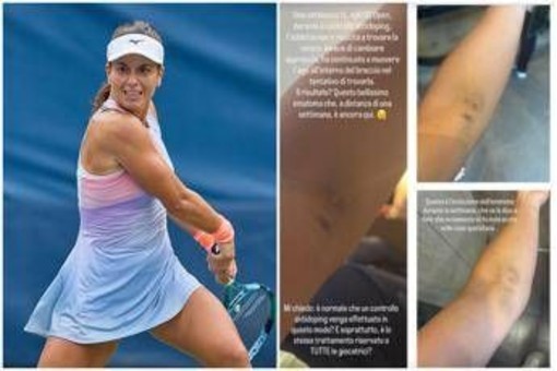 US Open, Stefanini e il livido sul braccio: "Colpa di un controllo antidoping..." US Open, Stefanini e il livido sul braccio: "Colpa di un controllo antidoping..."