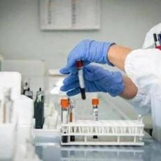 Miastenia gravis, al via studio su qualità di vita e impatto socio-sanitario