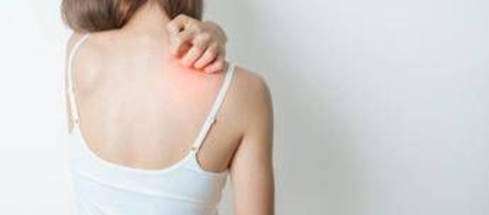 Farmaci, via libera in Europa ad anifrolumab penna pre-riempita per cura Les