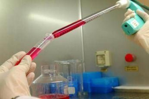 Melanoma uveale metastatico: "Tebentafusp raddoppia sopravvivenza a 5 anni"