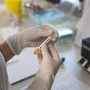 Cancro prostata metastatico ormonosensibile, nuovi dati su darolutamide mostrano benefici in sopravvivenza Cancro prostata metastatico ormonosensibile, nuovi dati su darolutamide mostrano benefici in sopravvivenza