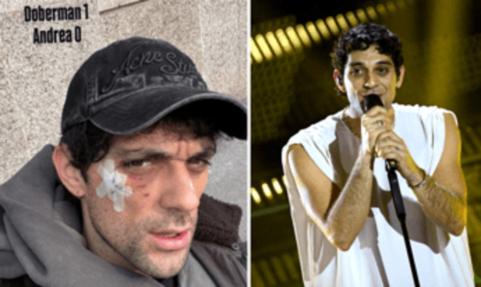 Bresh ferito al volto da un Dobermann, come sta il cantante