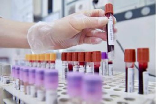 Alert su difterite in Ue, l'infezione continua a colpire in Europa Alert su difterite in Ue, l'infezione continua a colpire in Europa