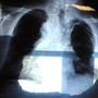 Bpco, pneumologa Foschino Barbaro: "Nella donna sintomi diversi, attenzione alle giovani"