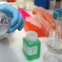 Tumori, al via studio per ridurre rischio recidive da cancro al seno