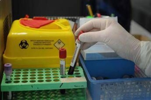 Tumori, nuovo test del sangue 'low cost' promette di scoprire diversi tipi di cancro