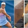 US Open, Stefanini e il livido sul braccio: "Colpa di un controllo antidoping..." US Open, Stefanini e il livido sul braccio: "Colpa di un controllo antidoping..."