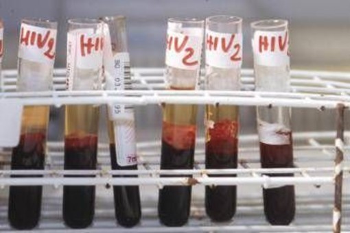 Hiv, il 90% dei pazienti sceglie terapia long acting Hiv, il 90% dei pazienti sceglie terapia long acting