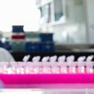 Milano, focolaio di tubercolosi all'Istituto di Medicina legale: 8 casi conclamati e 7 positivi. Indagini sull'origine del contagio