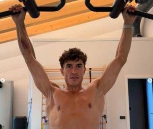 Marquez e la foto choc: il pilota mostra la spalla 'deformata'