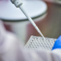Idrosadenite suppurativa, alla Camera focus su Lea, Piano cronicità e innovazione terapeutica Idrosadenite suppurativa, alla Camera focus su Lea, Piano cronicità e innovazione terapeutica