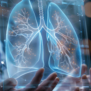 Cancro aggressivo al polmone, con mix di farmaci biologici raddoppia efficacia senza chemio